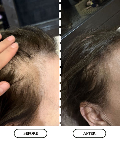 Boost | Hair Growth Oil