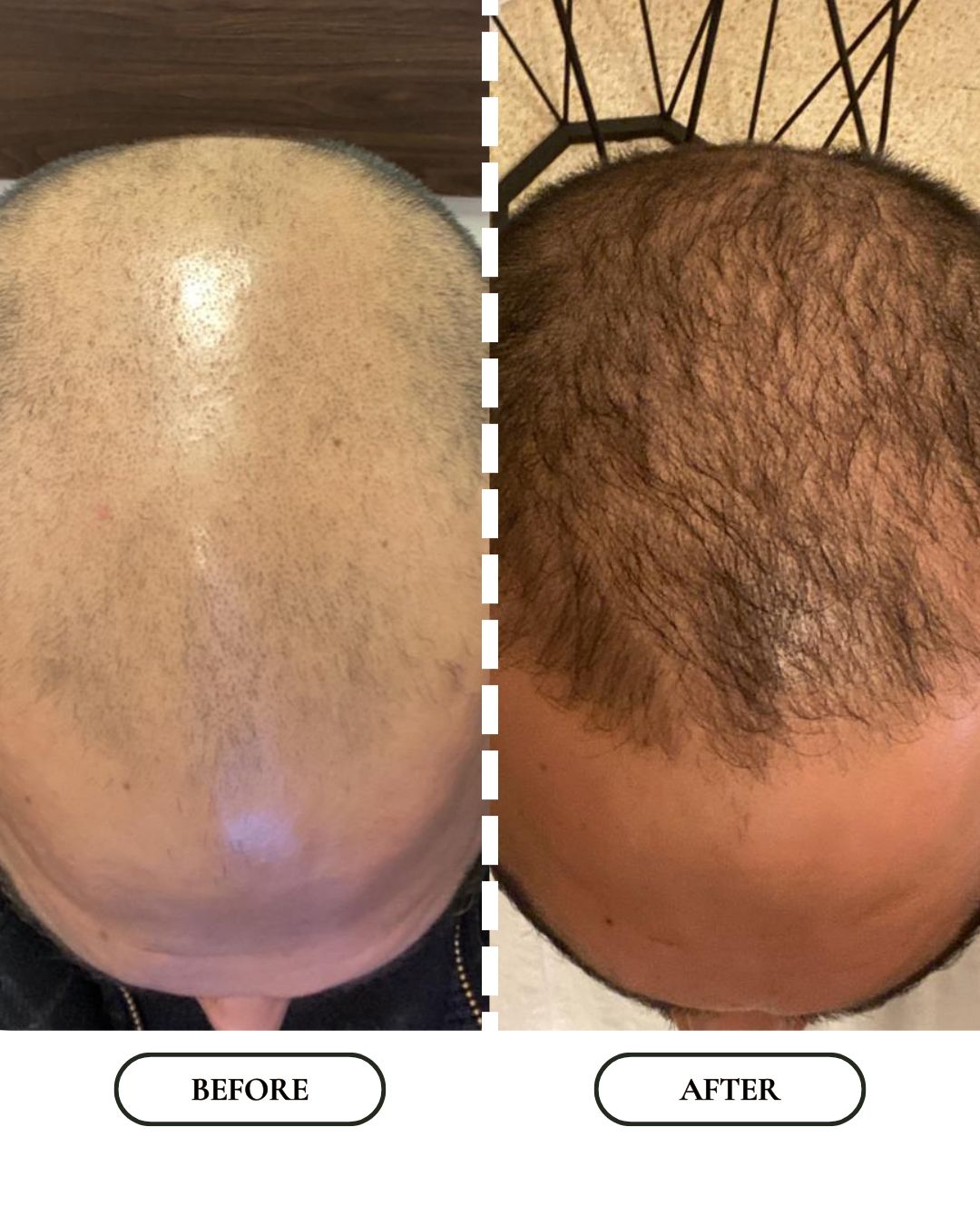 Boost | Hair Growth Oil