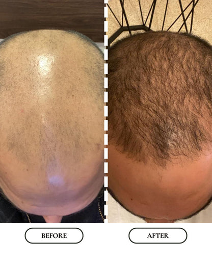 Boost | Hair Growth Oil